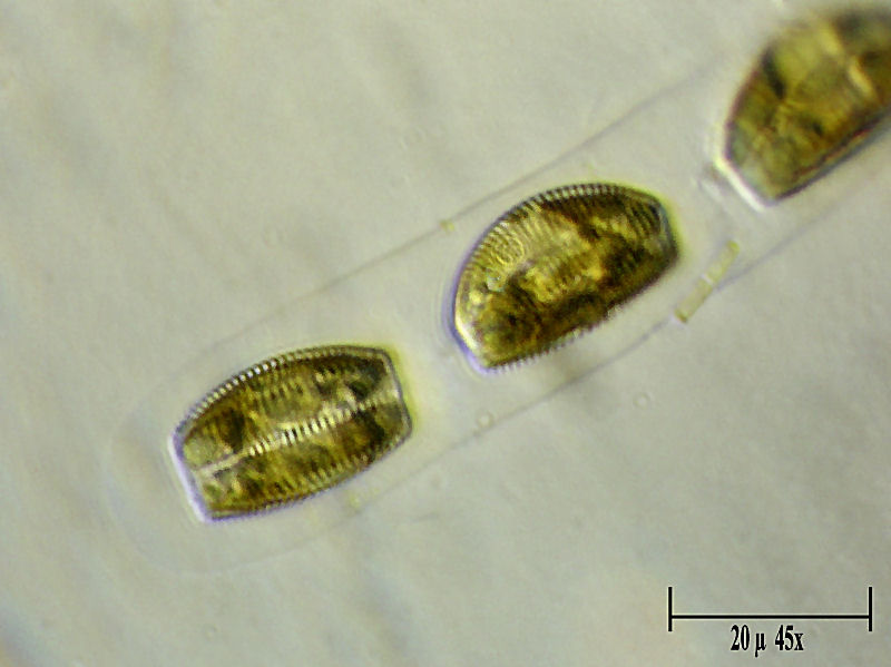 Encyonema sp.