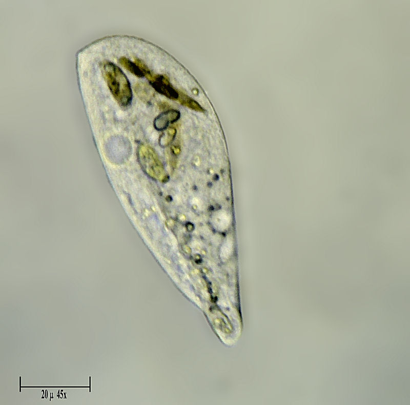 ciliato da identificare  (Blepharisma sp.)