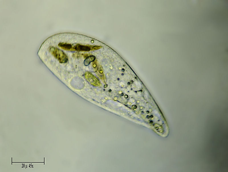 ciliato da identificare  (Blepharisma sp.)