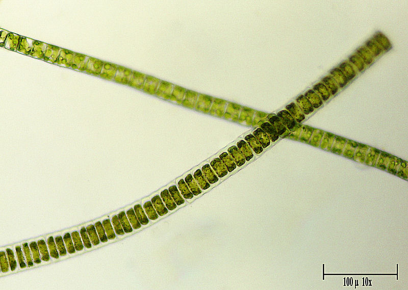 Alga da determinare  - Ulothrix ???