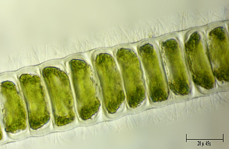 Alga da determinare  - Ulothrix ???