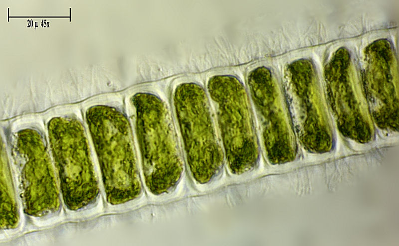 Alga da determinare  - Ulothrix ???