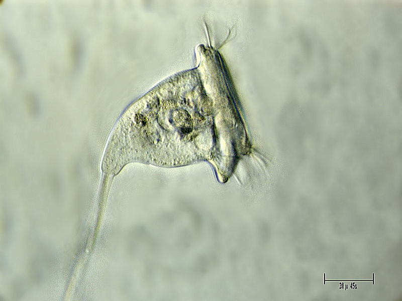 Vorticella sp.