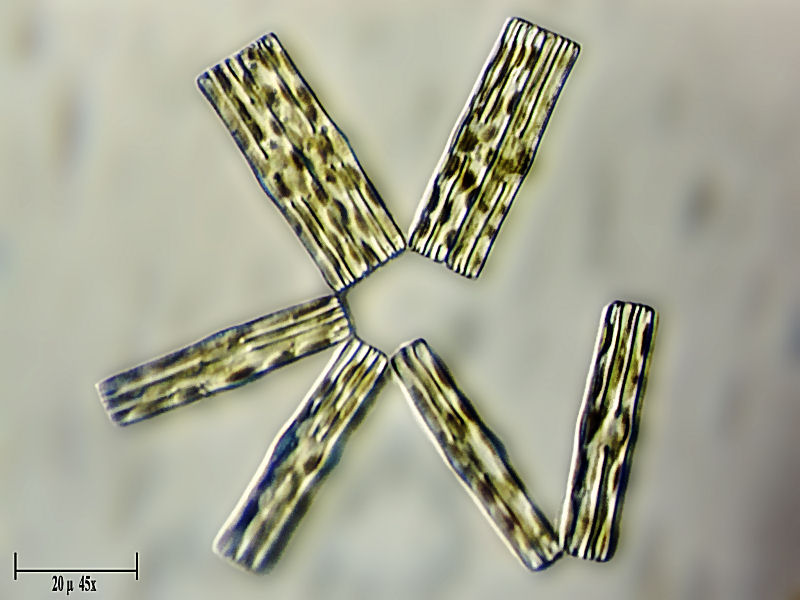 Tabellaria fenestrata ?