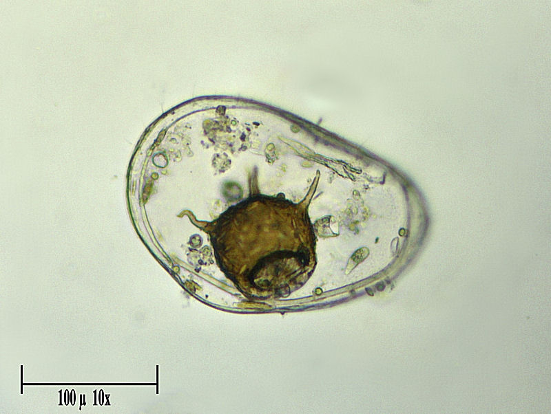 Centropyxis aculeata e ostracoide