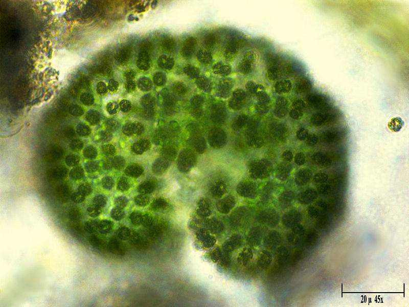 Coelosphaerium kuetzingianum  ??
