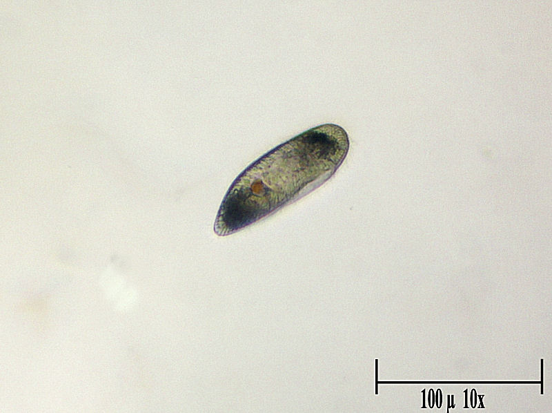 Frontonia sp. ? -  aiuto identificazione
