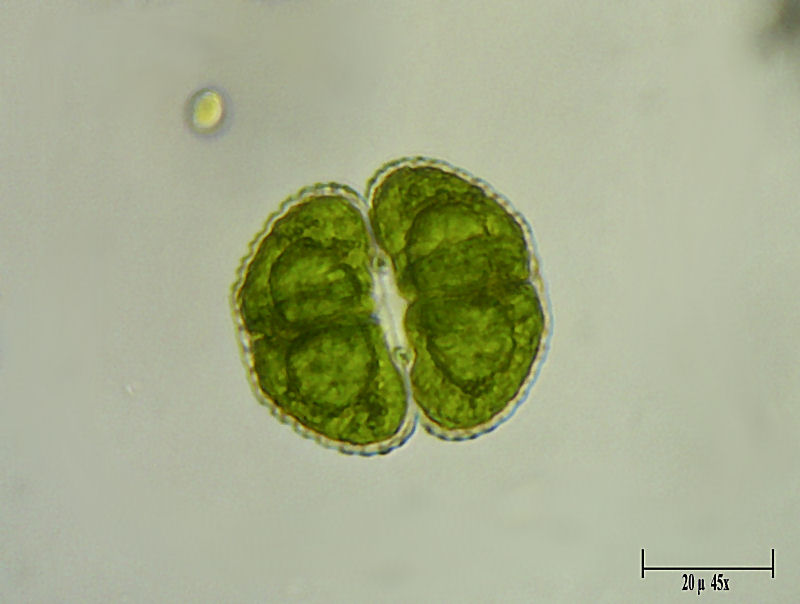 Cosmarium vexatum