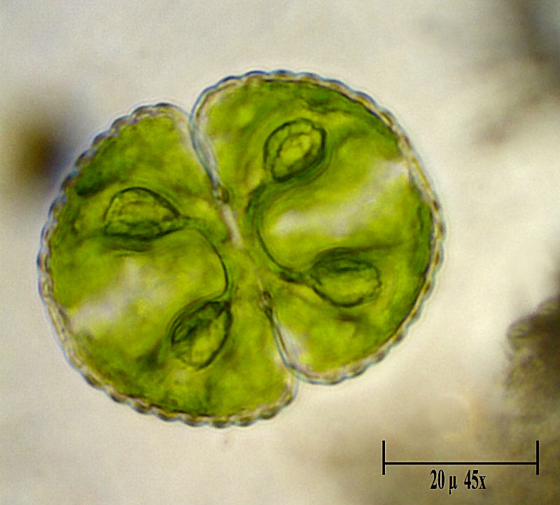 Cosmarium tetraophthalmum ?
