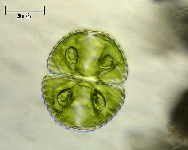 Cosmarium tetraophthalmum ?