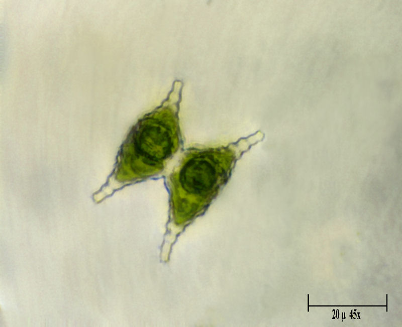 Staurastrum gracile ??