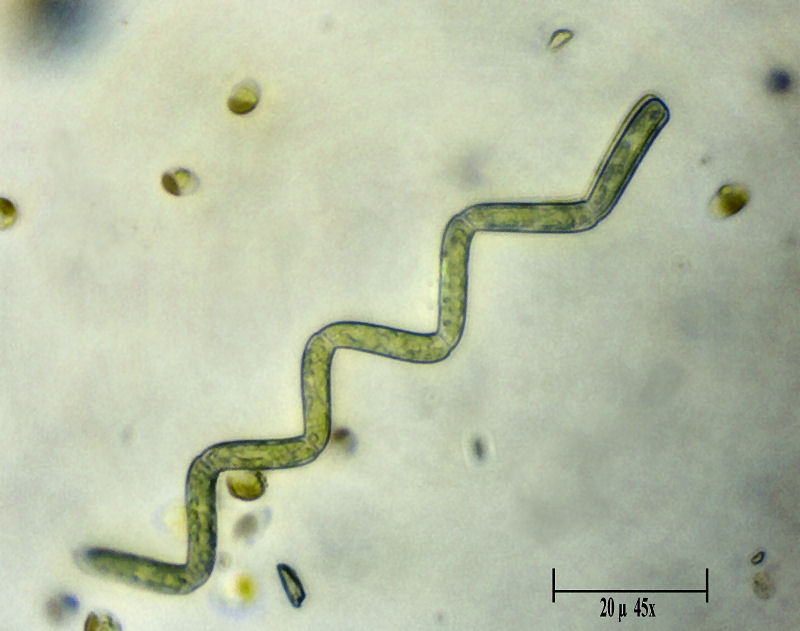 Spirulina si, spirulina no