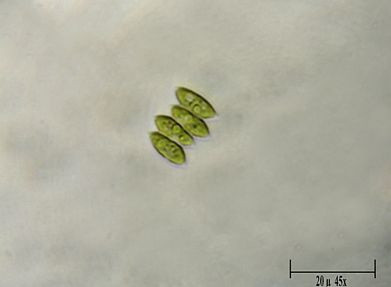 Scenedesmus sp