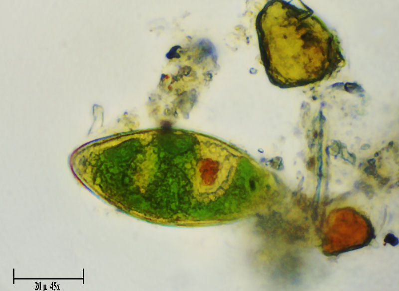 Euglenacea da identificare