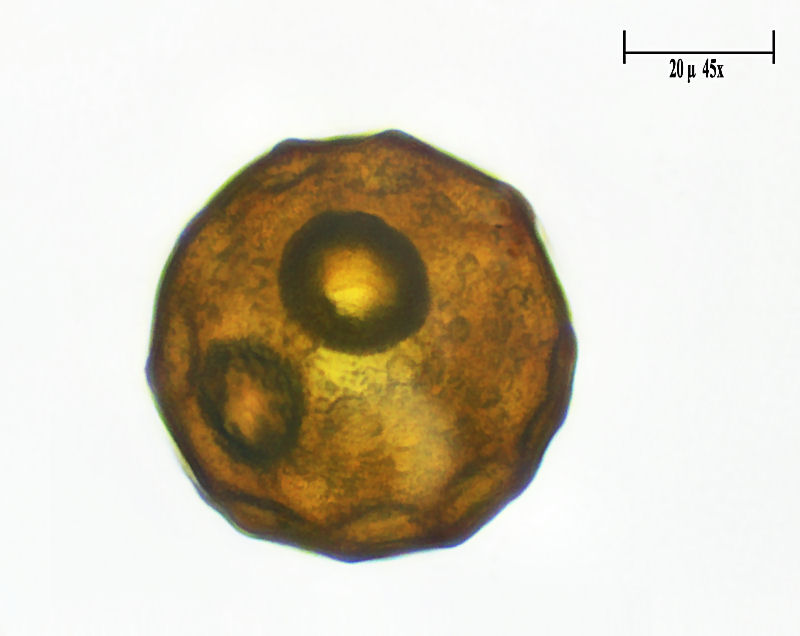 Arcella gibbosa