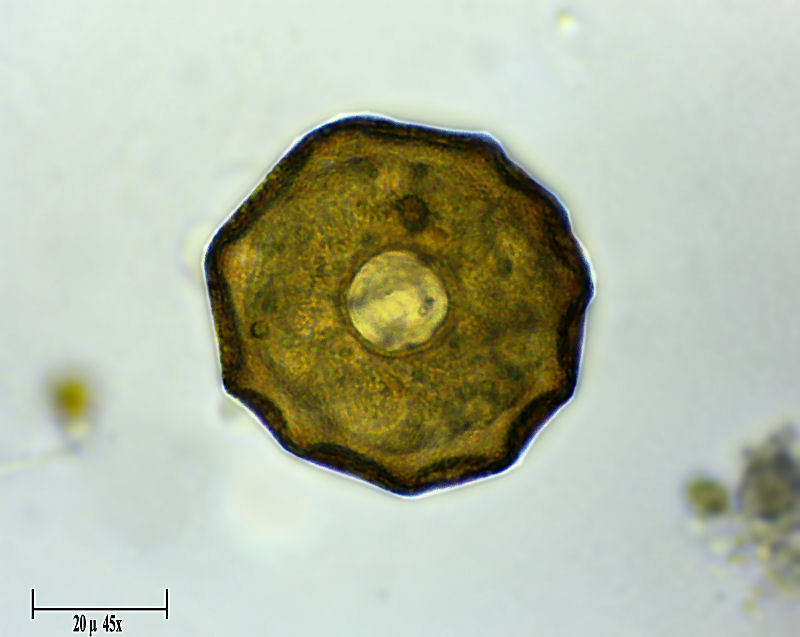 Arcella gibbosa