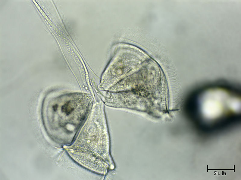 Zoothamnium sp.