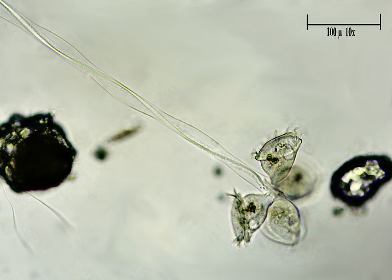 Zoothamnium sp.