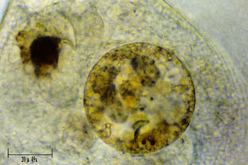 CILIATO DA IDENTIFICARE    _ Chilodonella ????