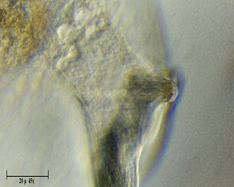 CILIATO DA IDENTIFICARE    _ Chilodonella ????