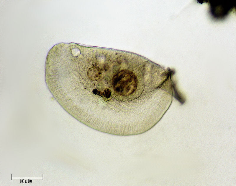 CILIATO DA IDENTIFICARE    _ Chilodonella ????