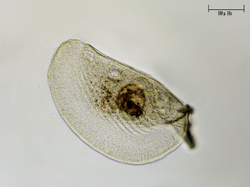 CILIATO DA IDENTIFICARE    _ Chilodonella ????
