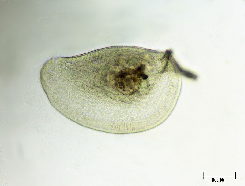CILIATO DA IDENTIFICARE    _ Chilodonella ????