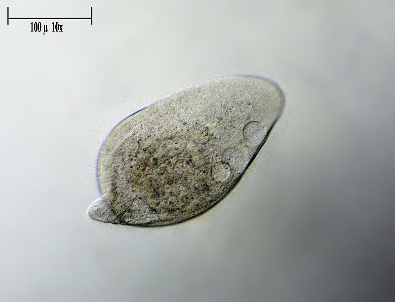 CILIATO DA IDENTIFICARE    _ Chilodonella ????
