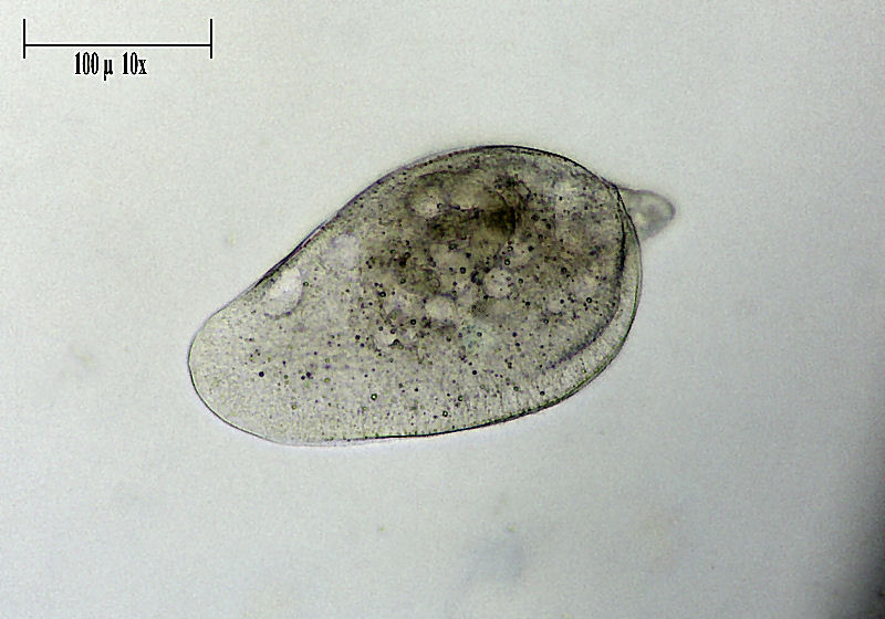 CILIATO DA IDENTIFICARE    _ Chilodonella ????