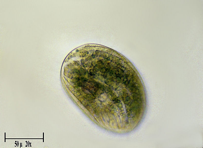 Pseudomicrothorax sp.  ??????????? molto forse