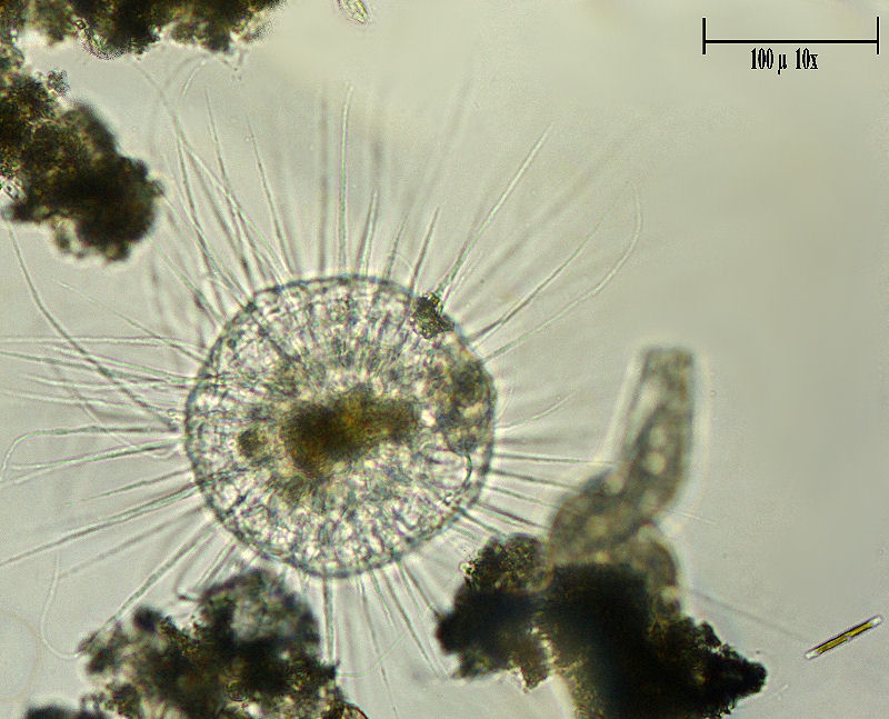 Helizoo enorme da identificare  [ Actinosphaerium sp. ]