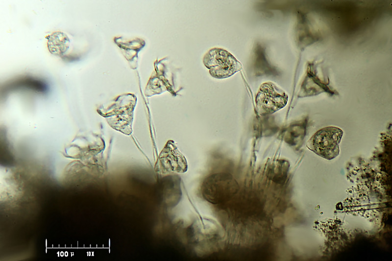 Zoothamnium sp.