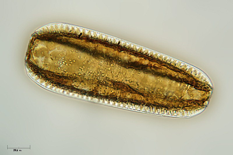 Surirella robusta