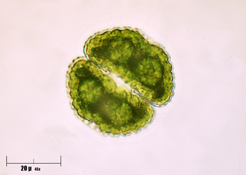 Cosmarium botrytis