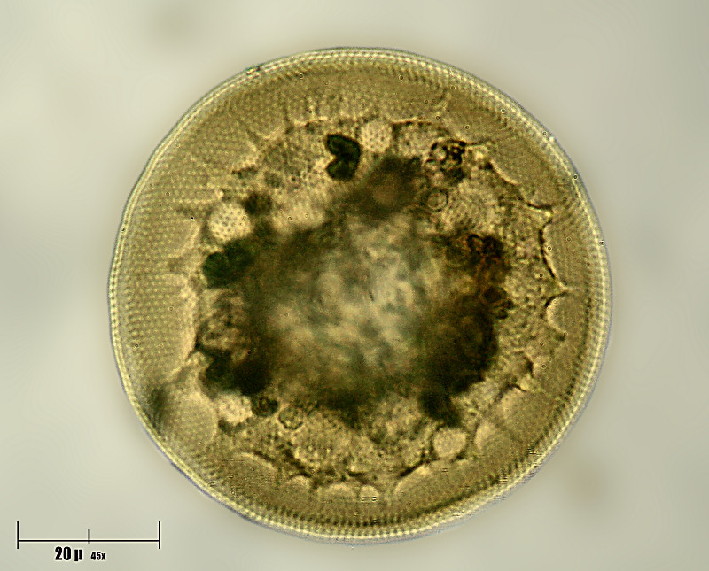Arcella sp.