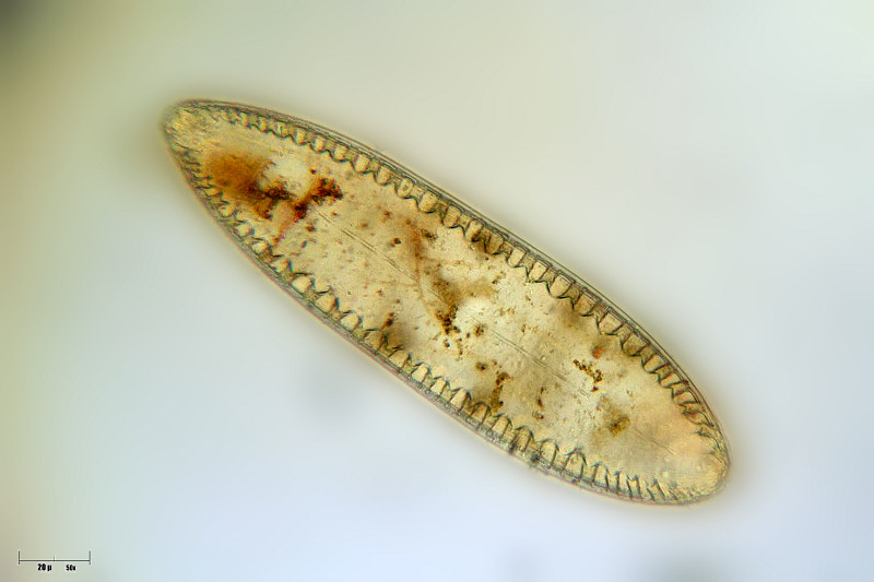 Surirella sp.