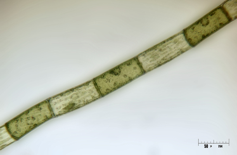 Microspora sp. ?????? - ( Mougeotia sp. )