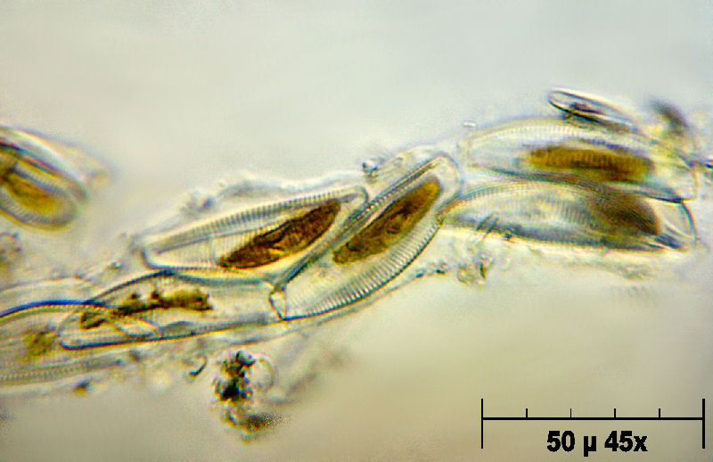 Encyonema prostratum