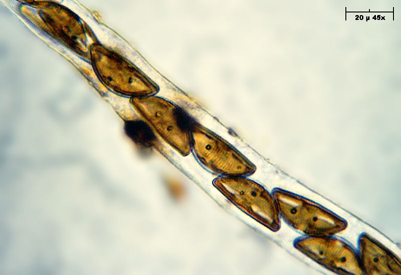 Encyonema caespitosum