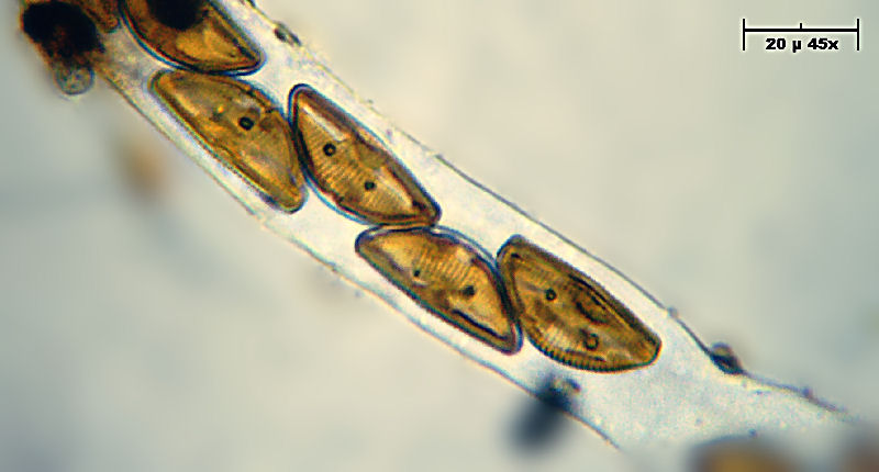Encyonema caespitosum