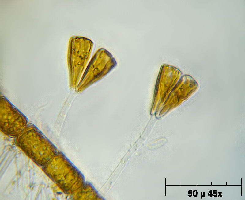 Gomphonema sp.