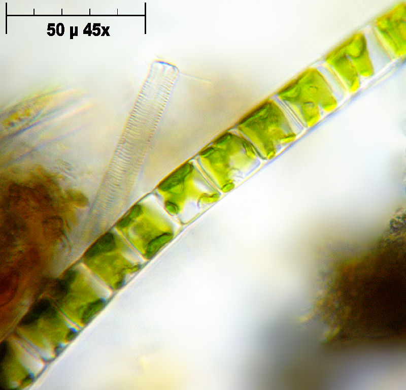 Ulothrix sp.