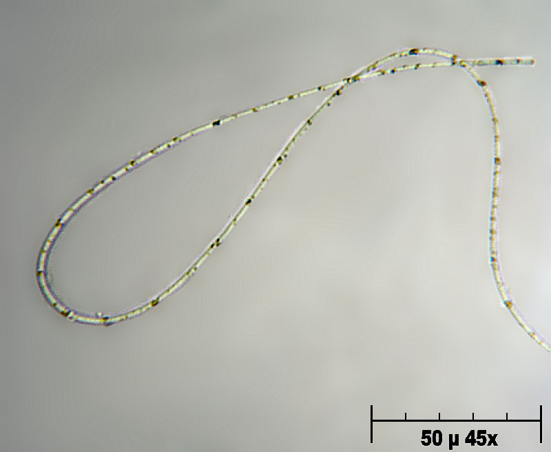 Protobatterio leopardato - Beggiatoa alba