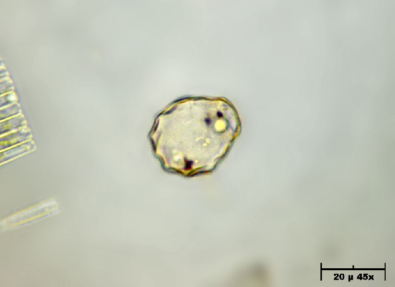 Tecameba - fosre Hyalosphenia ??????