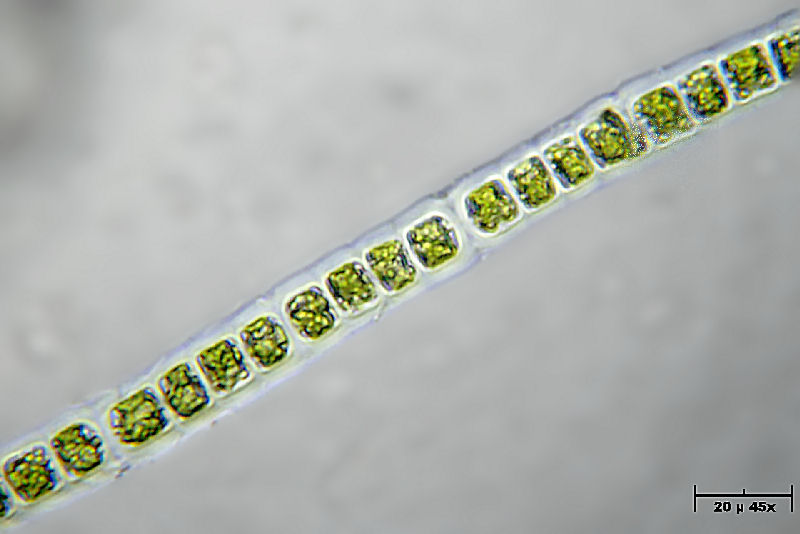 Hyalotheca sp.