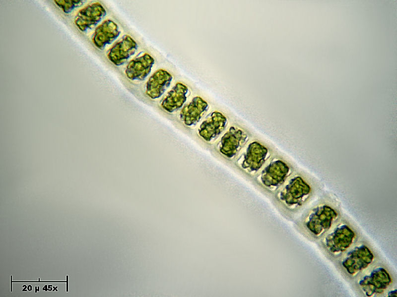 Hyalotheca sp.