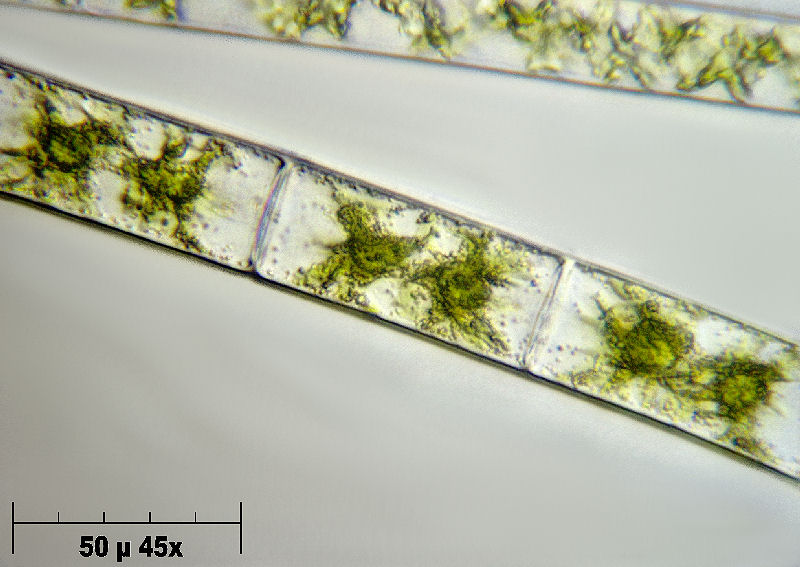 Zygnema sp.