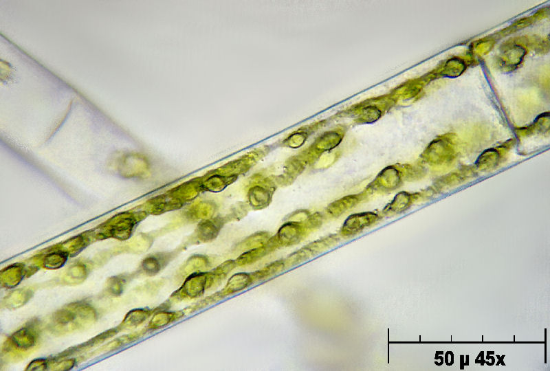 Sirogonium sp.