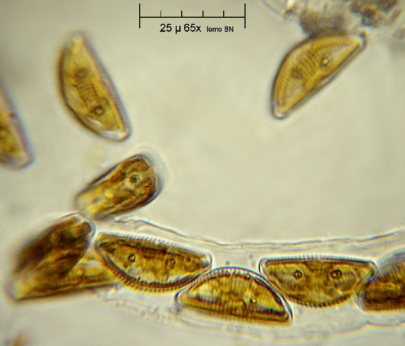 Encyonema caespitosum