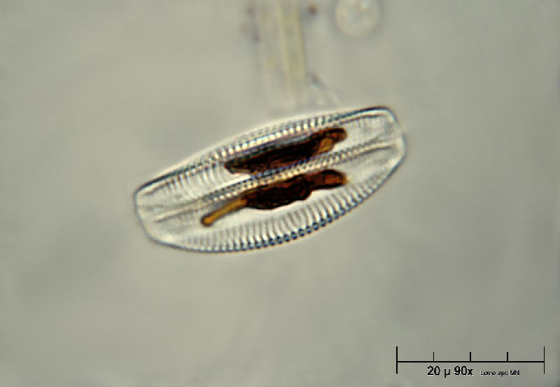 Encyonema sp.